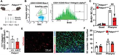 Pharyngeal pathology in a mouse model of oculopharyngeal muscular dystrophy is associated with impaired basal autophagy in myoblasts